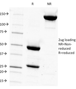 CD14 Antibody (LPSR/927), Novus Biologicals:Antibodies:Primary Antibodies